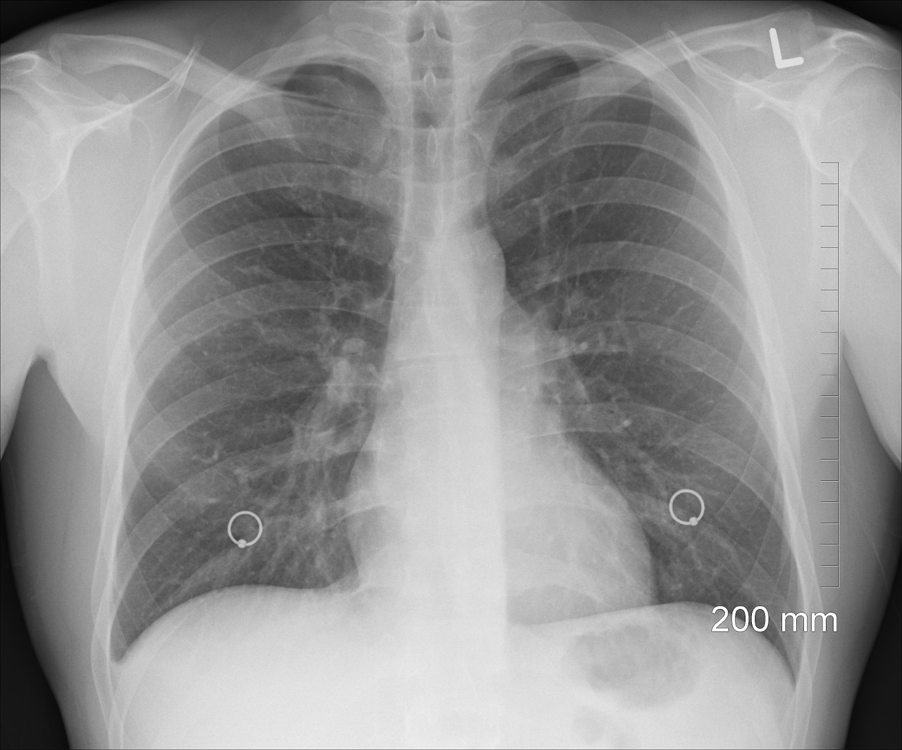 Diagnose-Lungengesundheit