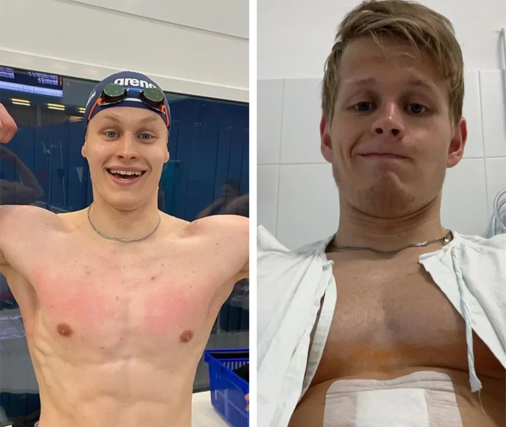 挪威游泳运动员布达佩斯医院