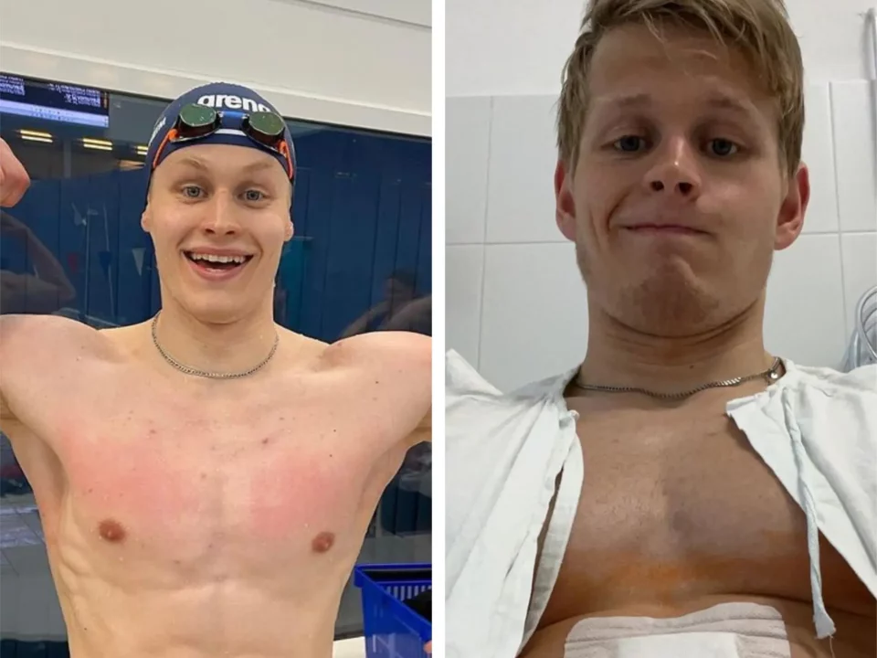 挪威游泳运动员布达佩斯医院