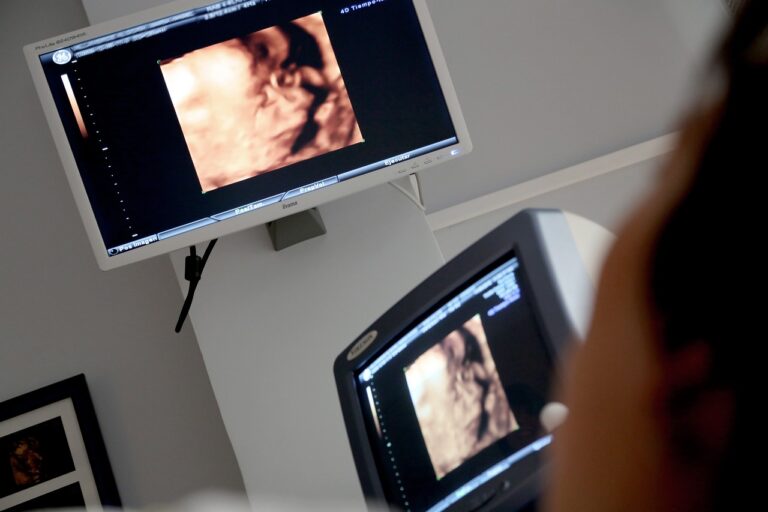 ultrasound abortion