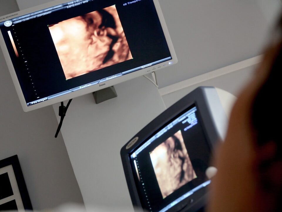 Ultraschall-Abtreibung