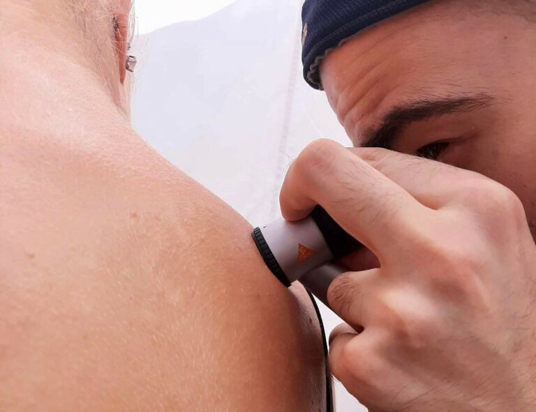 Cancer dermatologique
