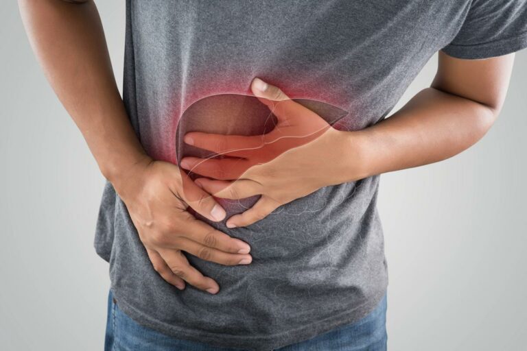 hepatitis a