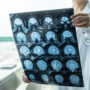 brain-eating amoeba